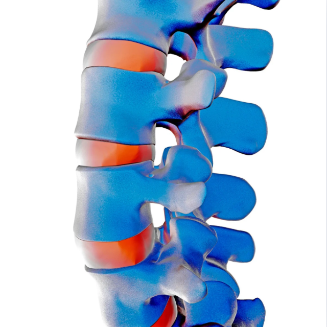 Système discal