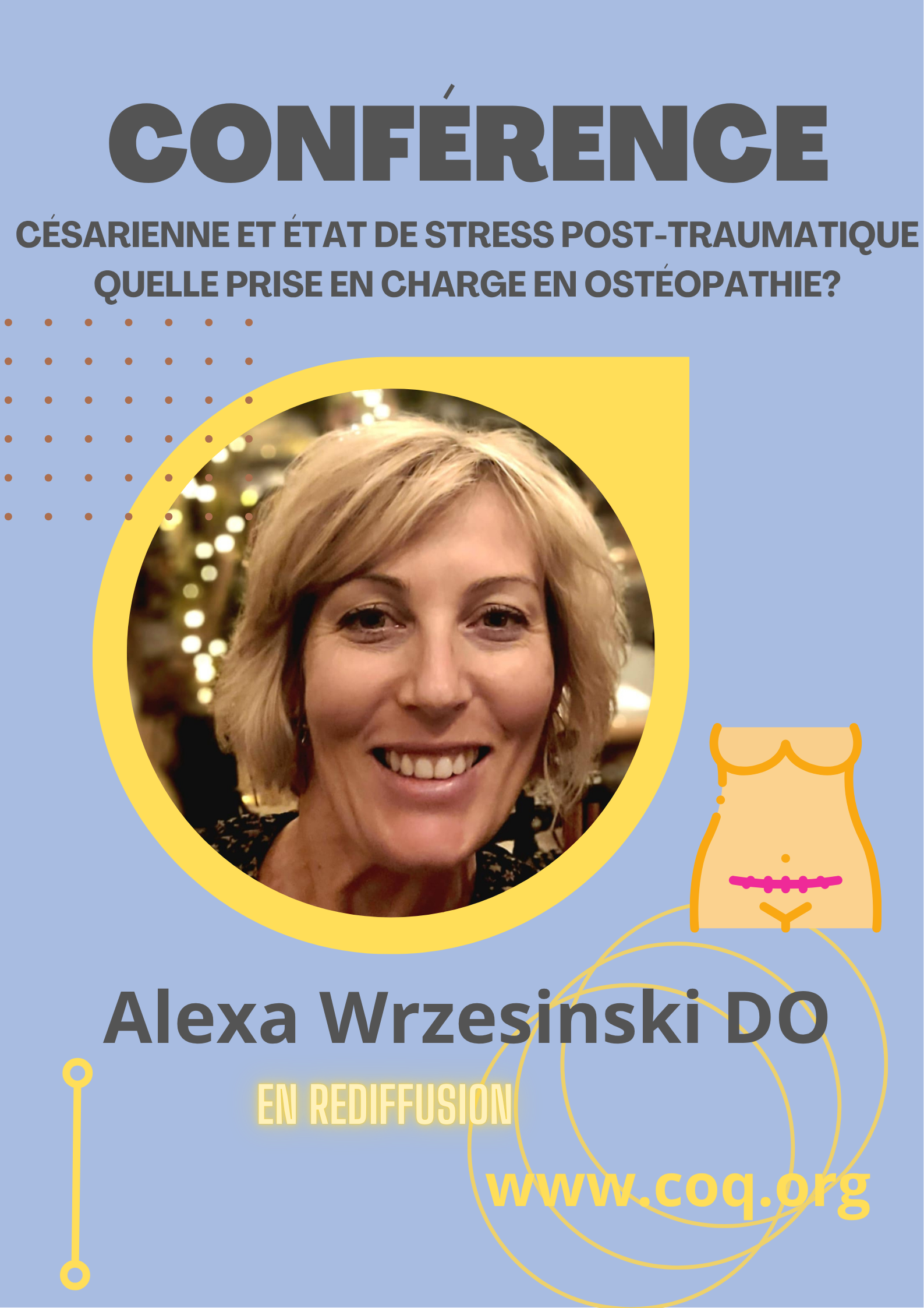 césarienne